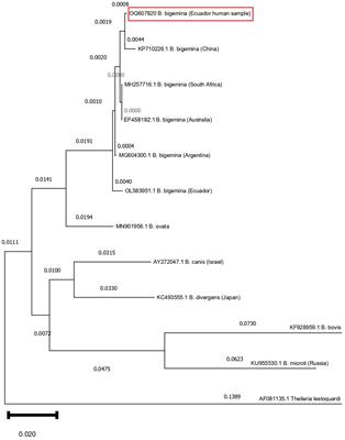 Case report: First report on human infection by tick-borne Babesia bigemina in the Amazon region of Ecuador